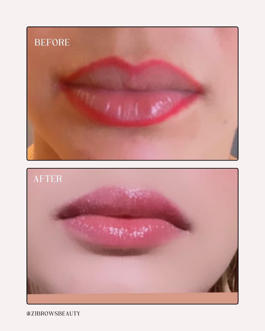 ZBrows before and after transformation 10